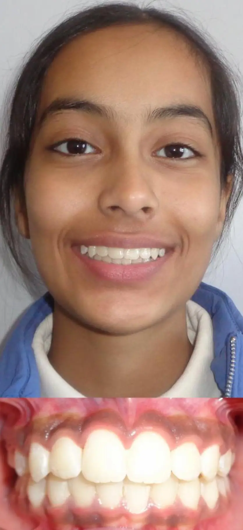 file (2)-images-3222.webp